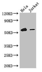 IKZF1 / IKAROS Antibody