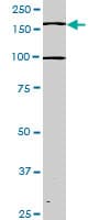 TEK / TIE2 Antibody (clone 3A5)