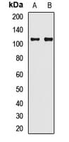 Polyclonal Rabbit anti-Human SYNPO / Synaptopodin Antibody (IHC, WB)