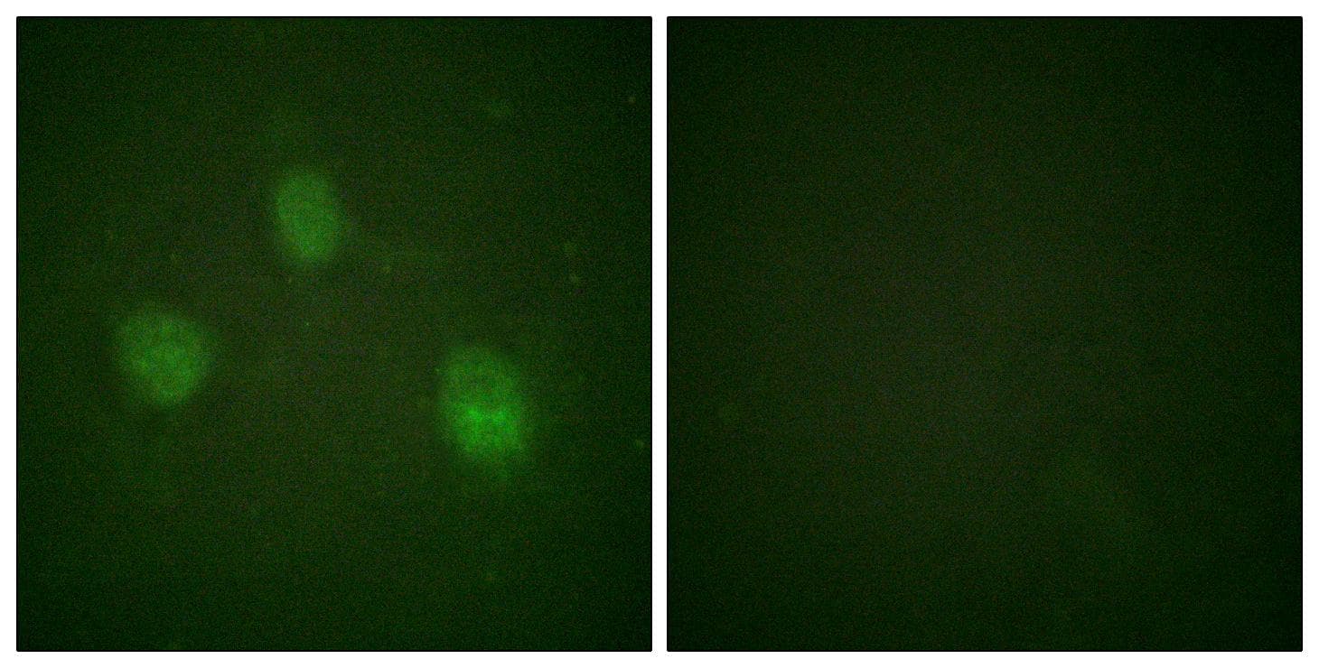 AURKB / Aurora-B Antibody (p12)