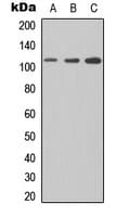 FCRL5 / CD307 Antibody (Internal)