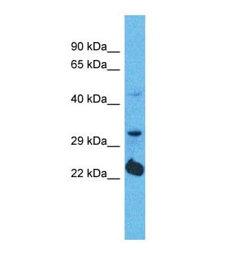 OR5D14 Antibody (C-Terminus)