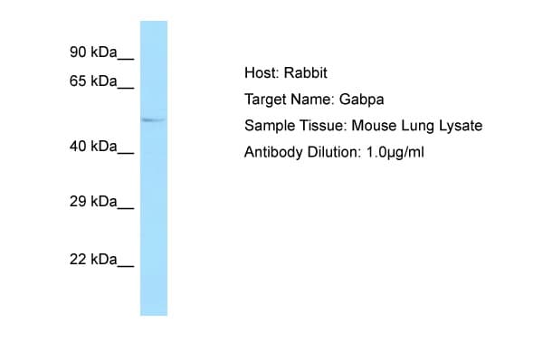 GABPA / NRF2 Antibody (N-Terminus)