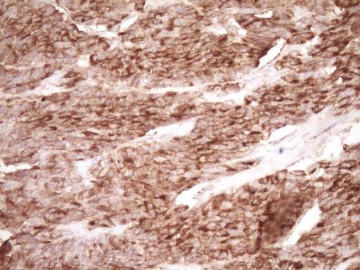 PROCR / EPCR Antibody (aa1-210, clone OTI3E7)
