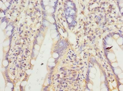 Polyclonal Rabbit anti-Human CNIH4 / HSPC163 Antibody (IHC, WB)
