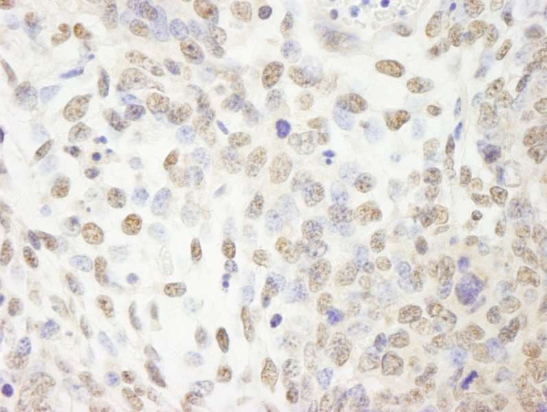 Polyclonal Rabbit anti-Human CPSF2 Antibody (aa450-500, IHC)