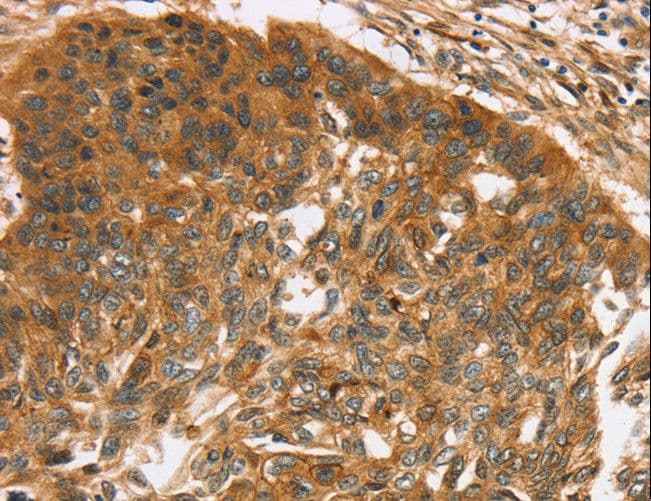 TNFSF15 / TL1A / VEGI Antibody