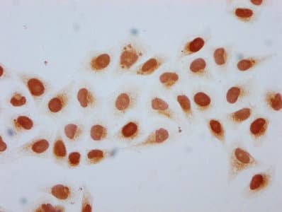 HIST1H2BN Antibody