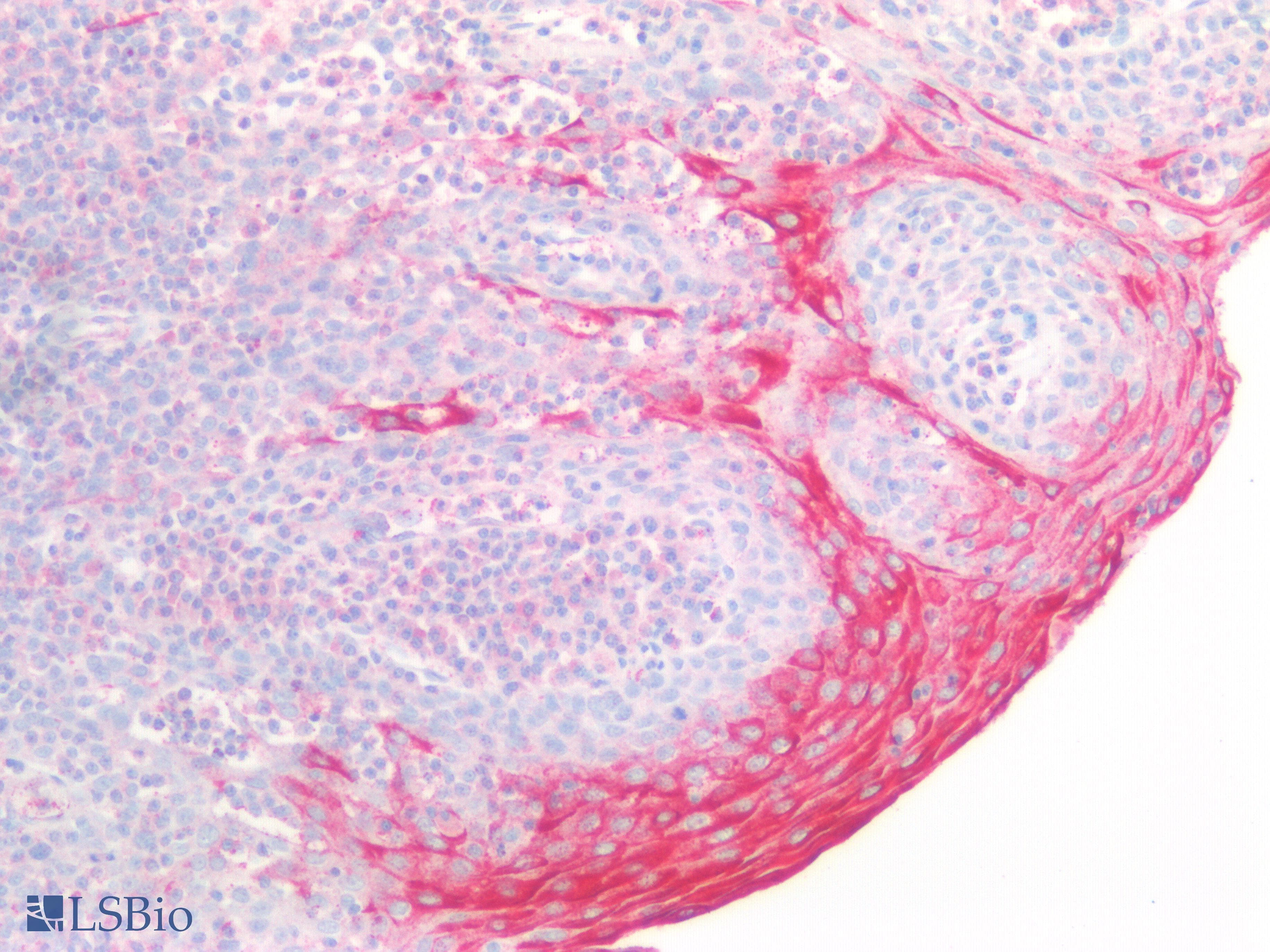 DGKA Antibody (aa305-531)