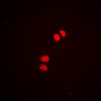 MEF2A / MEF2 Antibody