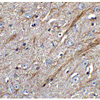 Polyclonal Rabbit anti-Human TNFSF12 / TWEAK Antibody (IHC, IF, WB)