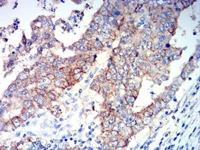 ALDH1A1 / ALDH1 Antibody (clone 2G1G4)