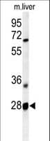 Polyclonal Rabbit anti-Human RTP2 Antibody (aa122-151, WB)