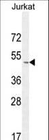 SELPLG / PSGL-1 / CD162 Antibody (aa379-405)