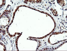 EPM2AIP1 Antibody (clone OTI1G9)