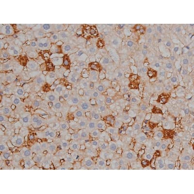 MAPT / Tau Antibody (phospho-Ser422)