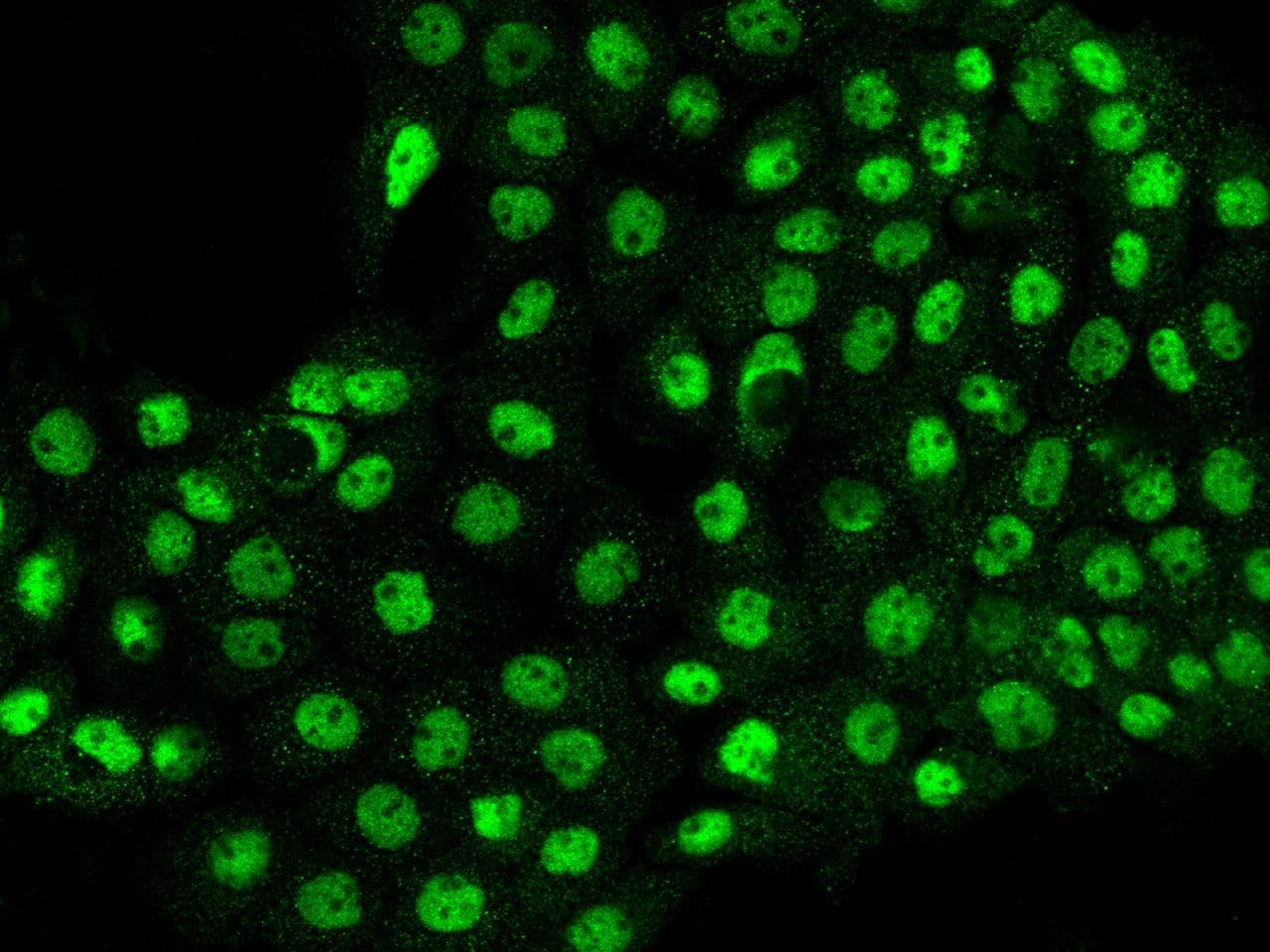 ZBTB7A / Pokemon Antibody