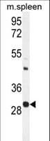 USF1 / USF Antibody (aa174-201)
