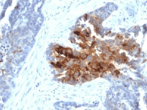 TAG-72 Antibody (clone B72.3 + CA72/733, Azide-free, BSA-free)