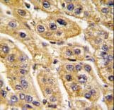 HIBCH Antibody (aa183-209)
