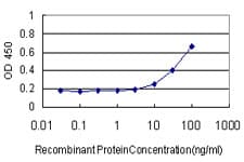 PathPlus™ FGF1 / Acidic FGF Antibody (clone 2E12)
