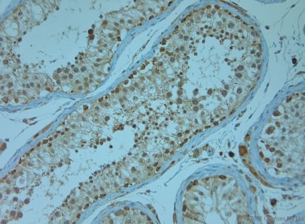 KCNJ13 / KIR7.1 Antibody (aa2-50)