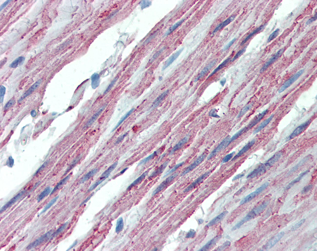 IHC-plus™ ITGA3 / CD49c Antibody (Internal)