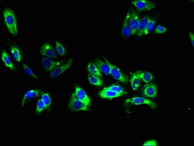 TMEM31 Antibody