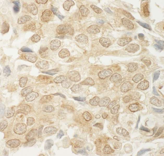 MED15 / ARC105 Antibody (aa450-500)