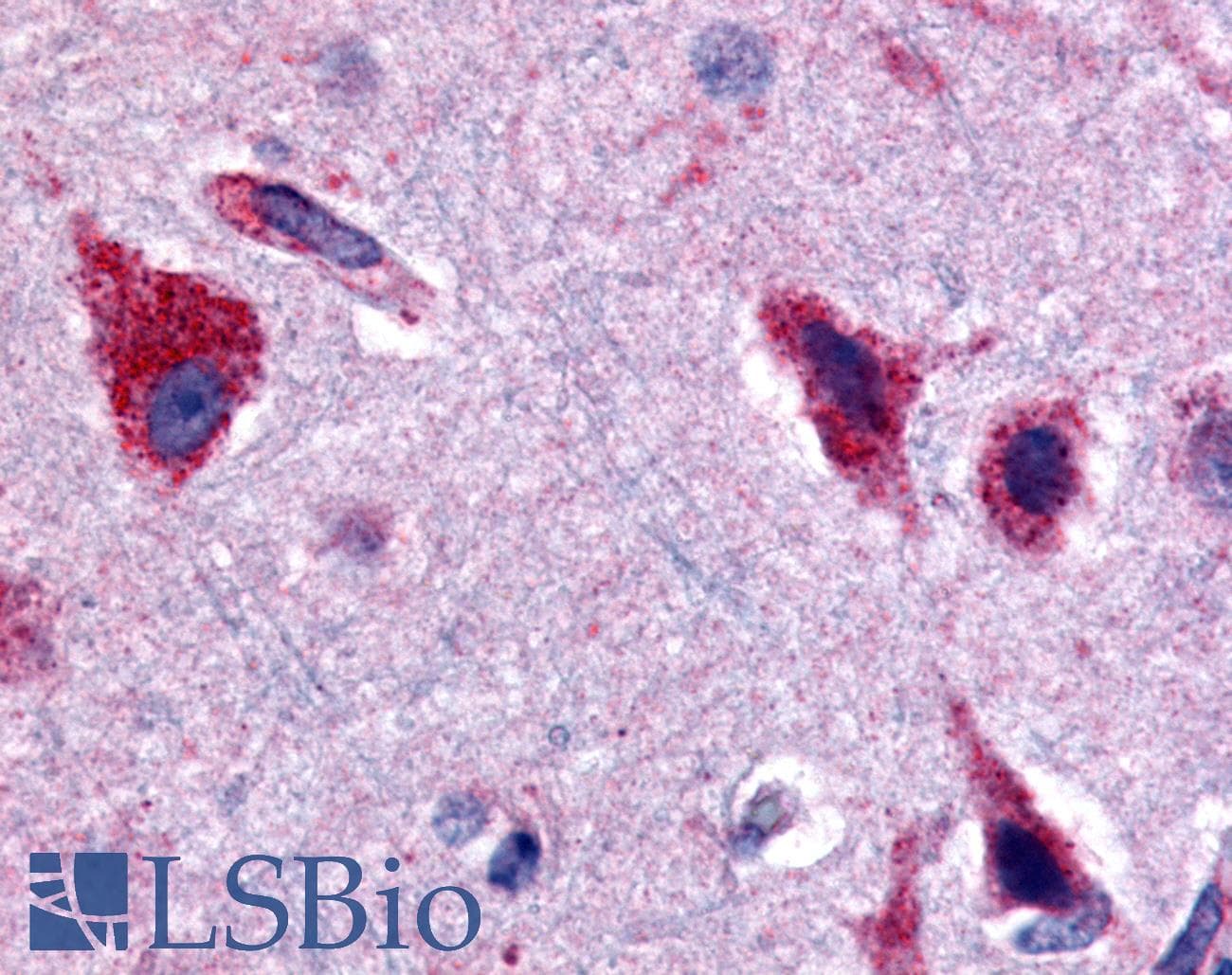 IHC-plus™ Ceramide Kinase / CERK Antibody (Internal)