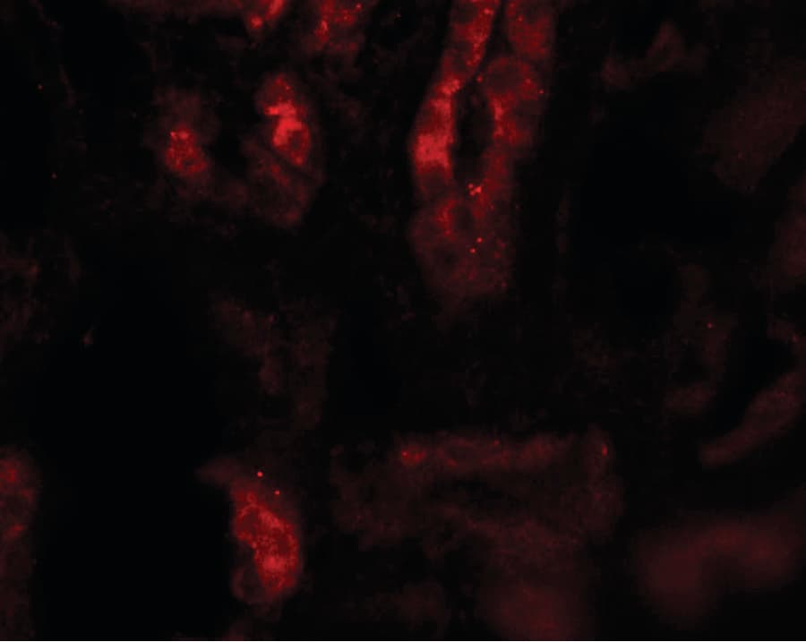 SARM1 / SARM Antibody