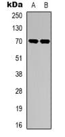 SPHK2 Antibody (C-Terminus)