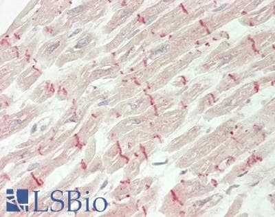 IHC-plus™ MSTN / GDF8 / Myostatin Antibody (aa 267-375)
