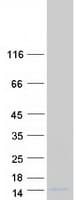 Human SPTSSB / C3orf57 Protein (Recombinant Myc-DDK (Flag))