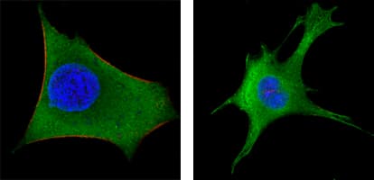 IHC-plus™ WNT1 Antibody (clone 10C8)
