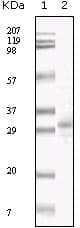HHV-8 ORF26 Antibody (clone 2F6B8)