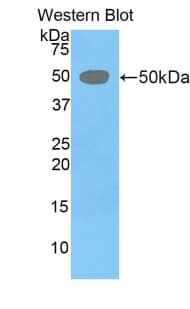LEFTYB / LEFTY1 Antibody (aa169-368)