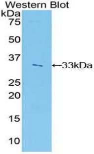 IGF2BP2 Antibody (aa293-557)