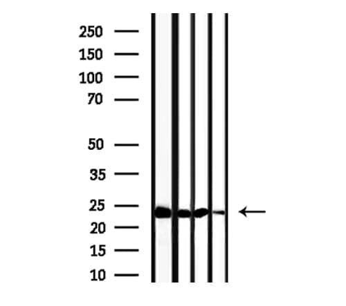 TPT1 / TCTP Antibody