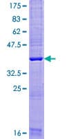 Human TMEM88 Protein (Recombinant GST)