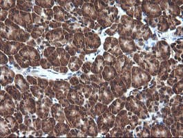 VHL / Von Hippel Lindau Antibody (clone OTI1E1)