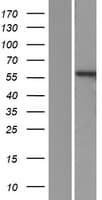 PPP3CB Protein (Over-Expression Lysate Myc-DDK (Flag))