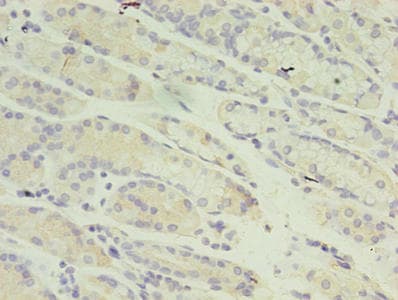 RANBP2 / TRP1 Antibody