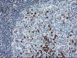 PDXK / PNK Antibody (clone OTI5H5)