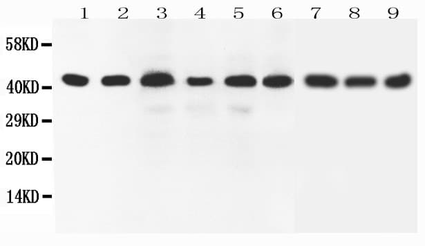 Polyclonal Rabbit anti-Human SOX7 Antibody (aa370-388, WB)