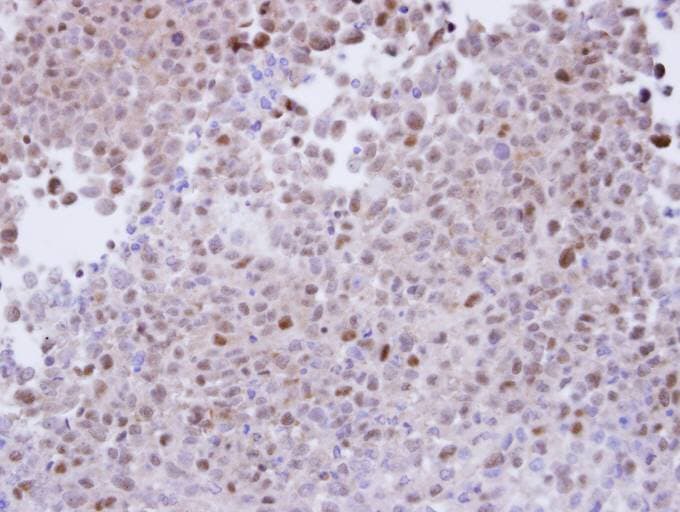 PSMA7 Antibody (aa10-247)