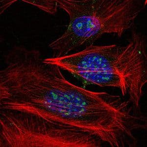 MAP3K2 / MEKK2 Antibody (clone 4B4)