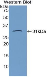 CD274 / B7-H1 / PD-L1 Antibody (aa48-290)