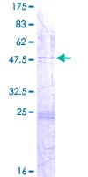 Human DUSP26 / MKP8 Protein (Recombinant GST)