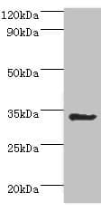 AIMP1 / EMAP II Antibody (aa25-180)